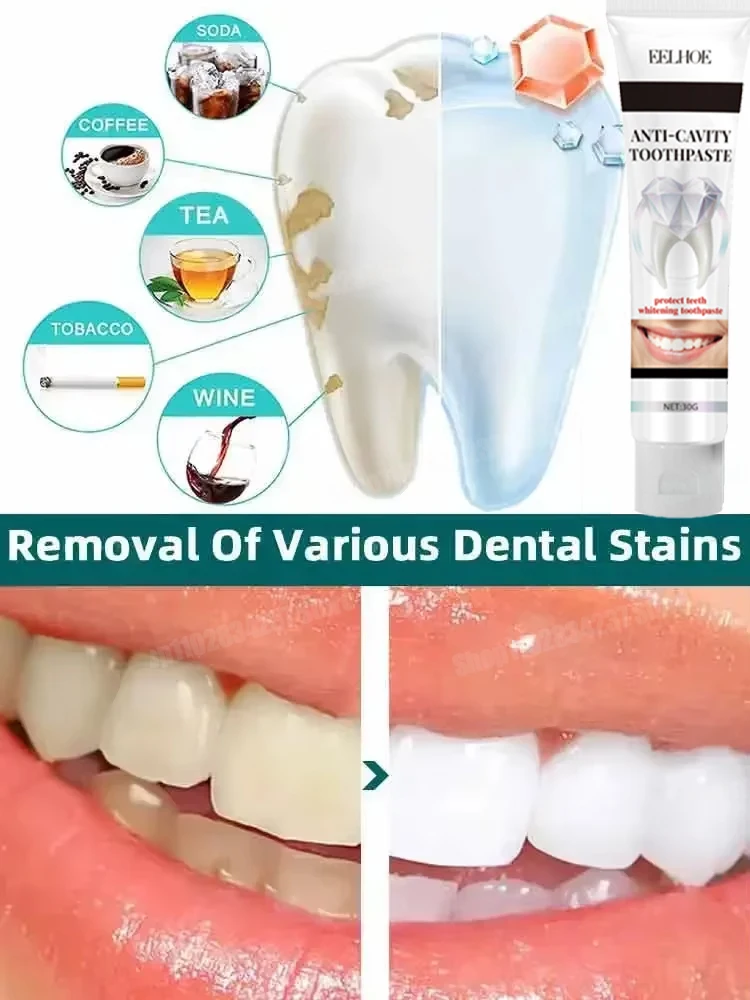 Dentifricio sbiancante Essenza sbiancante per denti Pulizia dell'igiene orale