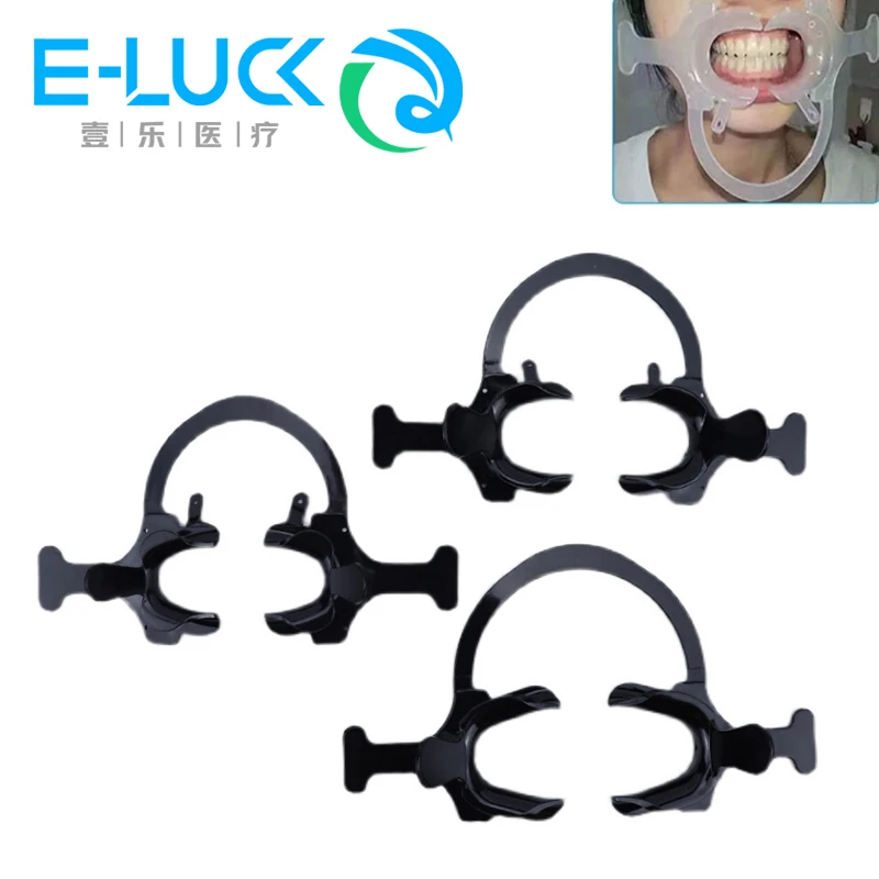 Dental policzek zwijacz ortodontyczny otwieracz do ust kształt C boczny otwarty Dental ortodontyczny czarny ząb wewnątrzustna warga