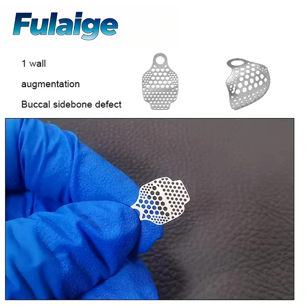 

Dental OB2 GBR 3D Titanium Mesh Guided Bone Regeneration Membrane Plate Implant Bone Formation Bone Incremental SmartBuilder