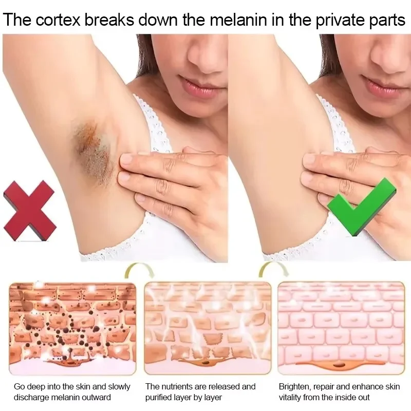 كريم تبييض الأجزاء الخاصة تحت الإبط لوشن تبييض تبييض بعقب الركبة سطع الفخذ الداخلي الأجزاء الحميمة إزالة الميلانين الداكنة
