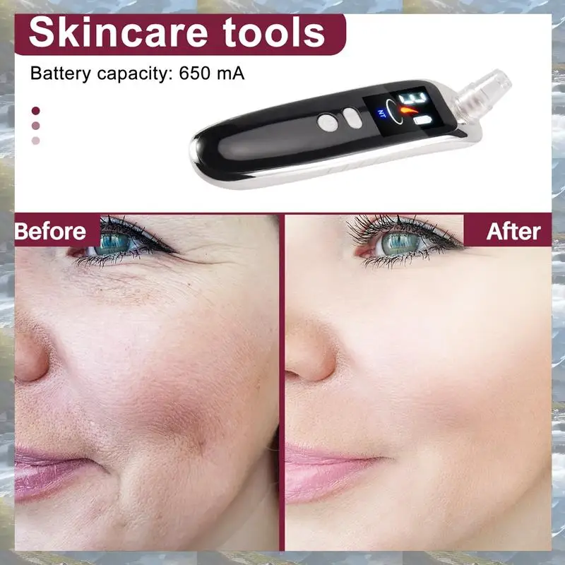 Aspirador de espinillas eléctrico para cara, nariz, acné, punto negro, espinillas, herramientas para el cuidado de la piel del poro, máquina con 6 cabezales