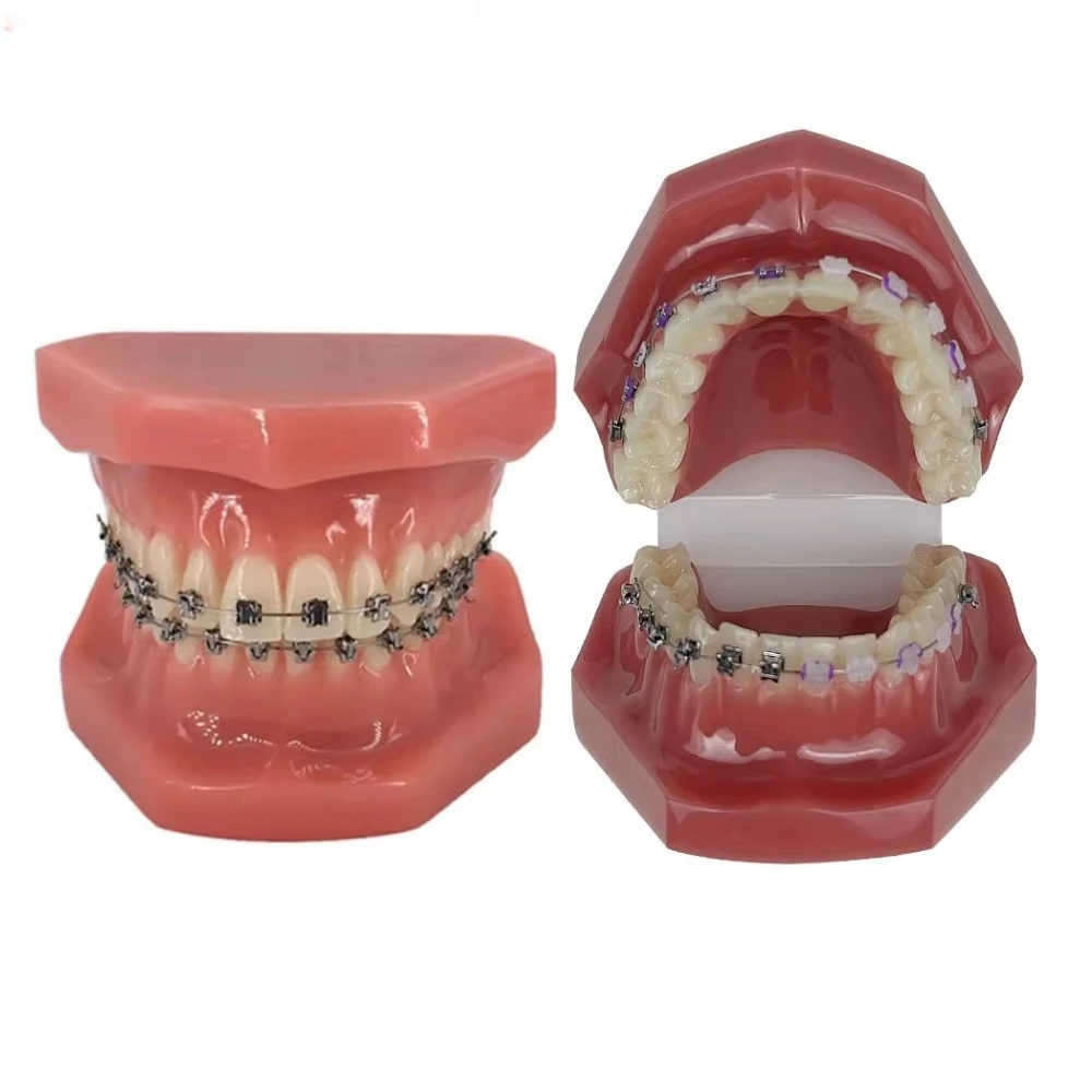 New Orthodontic Teeth Model With Braces Bracket Metal/Ceramic Self-Locking Orthodontic Dental Model Dentistry Treatment For Demo
