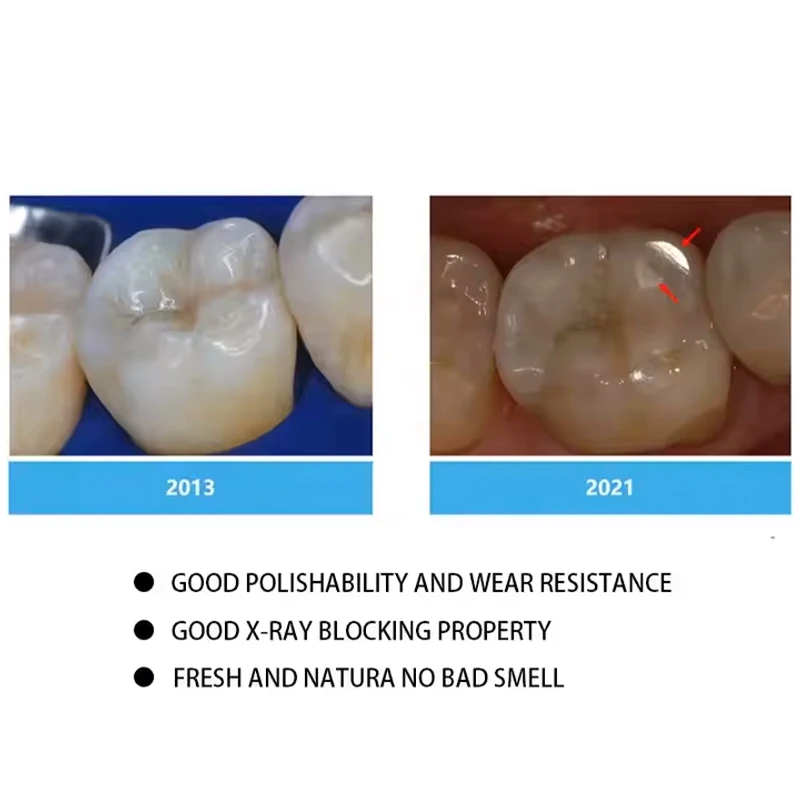 Dental Filling Resin Cavity Filling Resin Material for Filling Cavities Front Teeth Cover Simulated Missing Teeth Crown