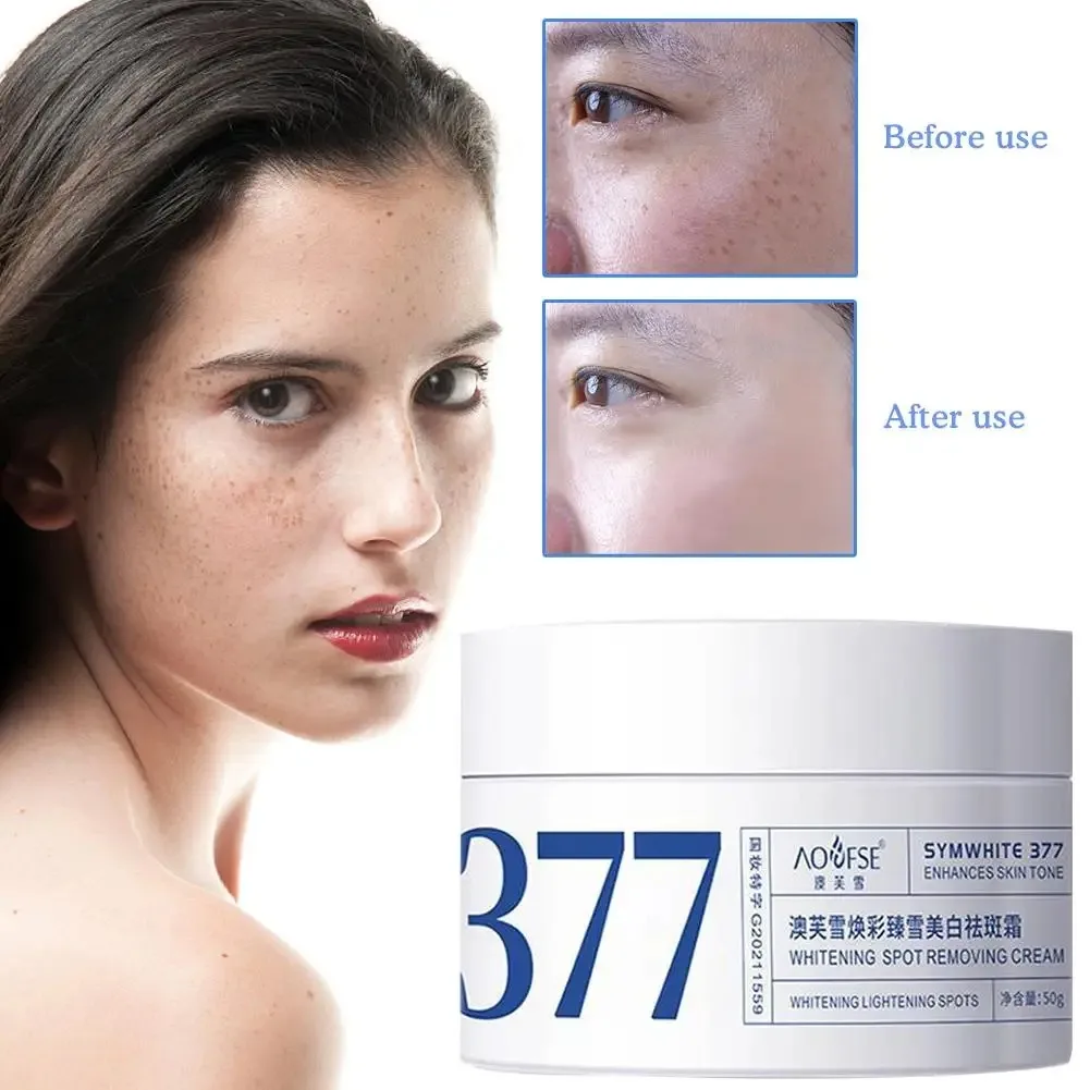 

50g 377 Effective Whitening And Freckle Removing Cream Fades Facial Whitening Moisturizing Skin Cream Spots Skin Brightens