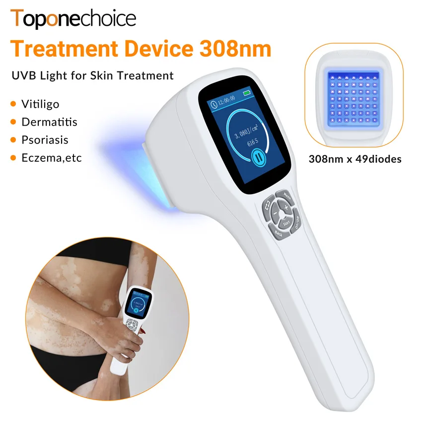 Portable 49 Diodes 308nm UVB Phototherapy Ultraviolet Light Therapy Instrument for Vitiligo Psoriasis Eczema Skin Deseases