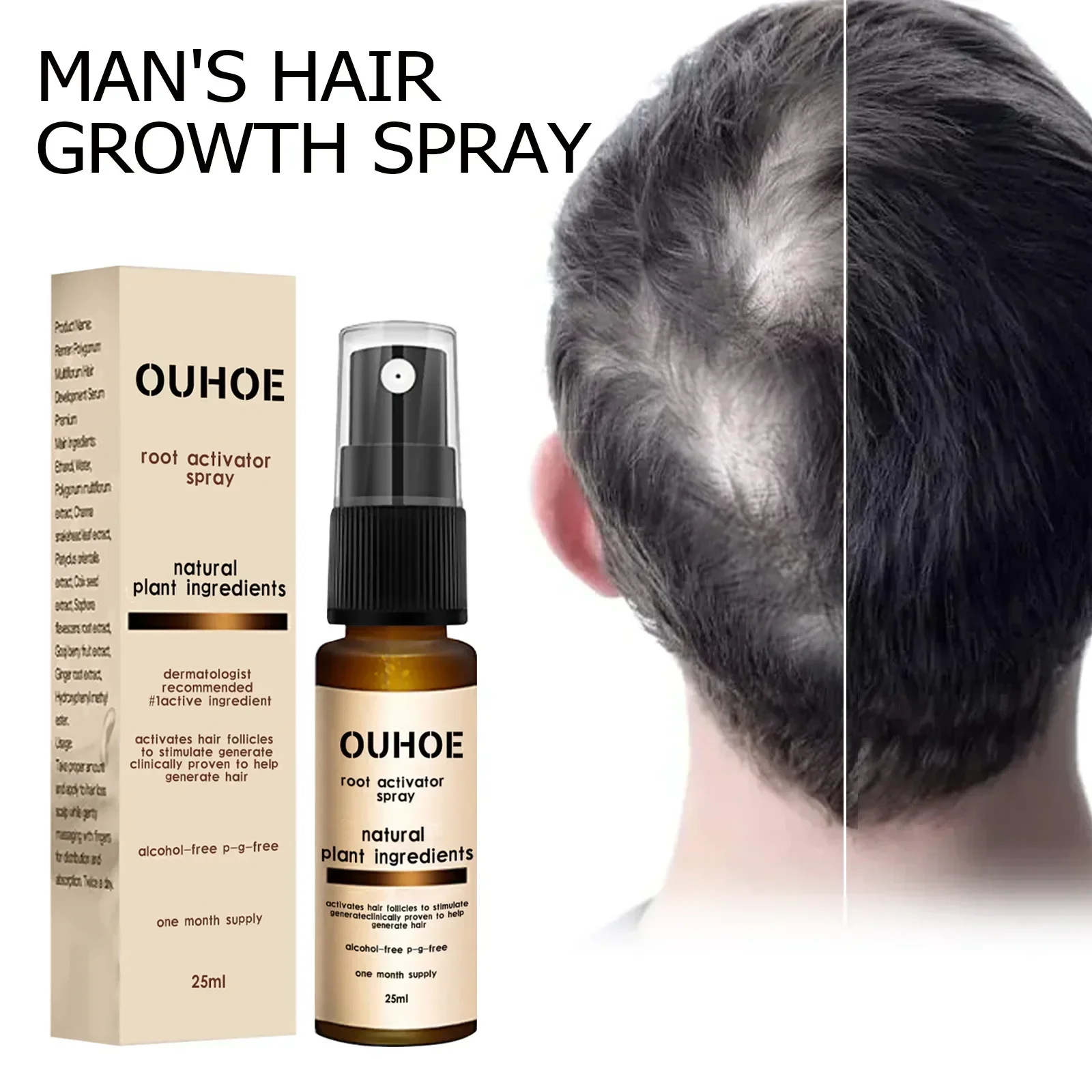 Hair Loss Treatment Spray Nourishing Regrowth Root Thicken Anti Fall Prevent Baldness Repair Damage Grow Fast Hair growth Spray