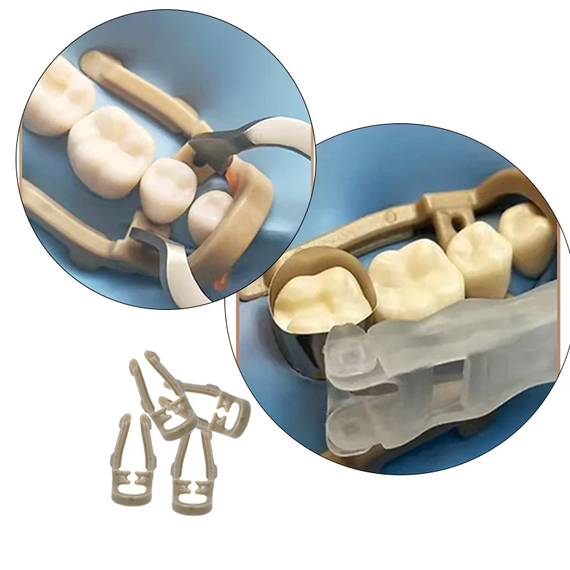 4 sztuk/pudło dystalne rozszerzenie gumy przedmolowej Dental Dam zacisk żywica bariera klip do noszenia jako długie lub krótkie stomatologia zęby