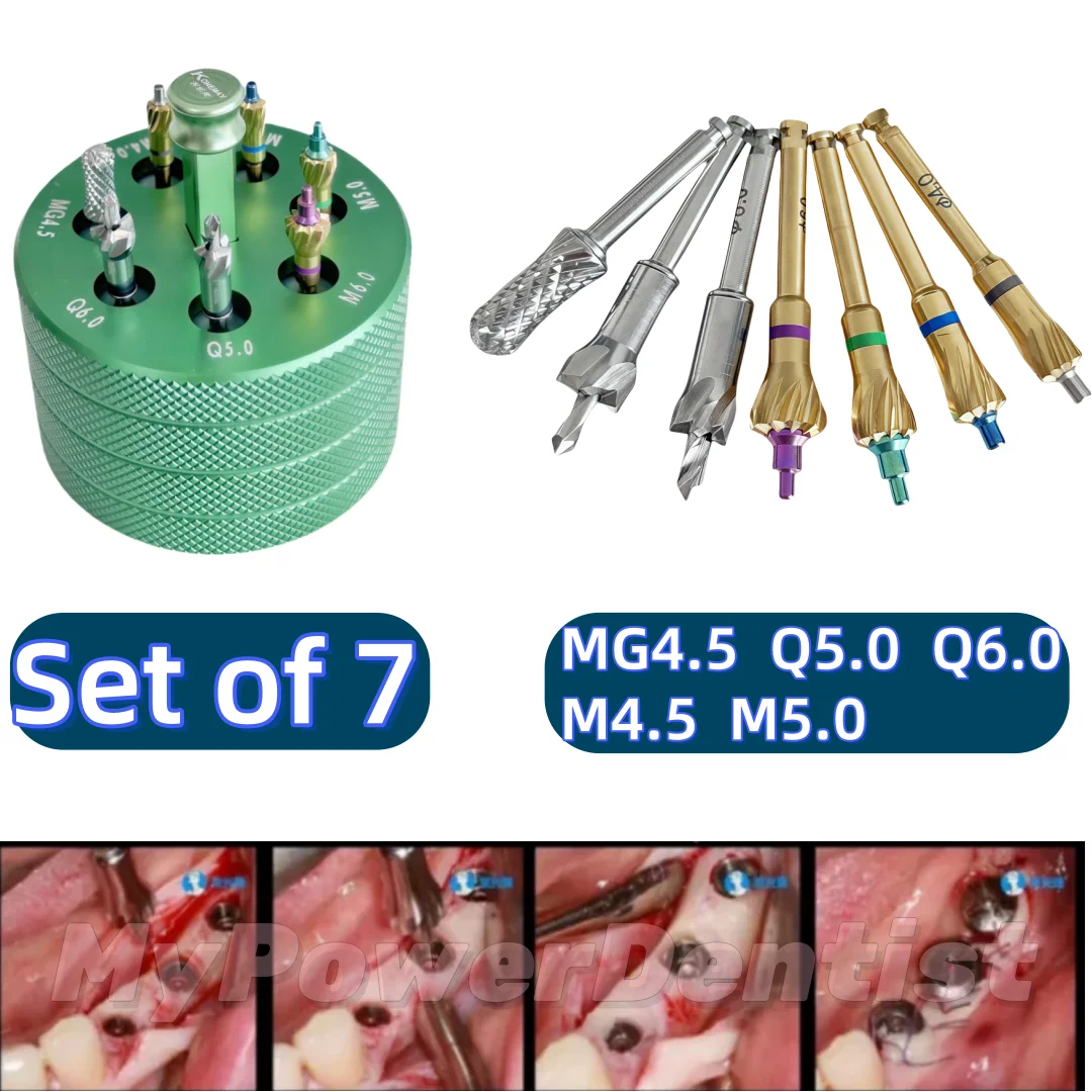 

1 комплект, профилер для костей, зубной хребет, контурные сверла, триммер, коллекторная дрель Oss, 7 шт., с коробкой