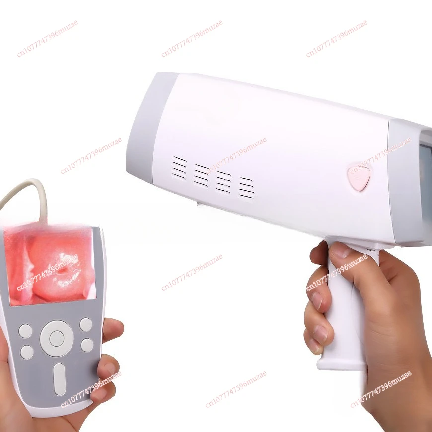 

Handheld Digital Video Colposcope for Gynaecology Analysis