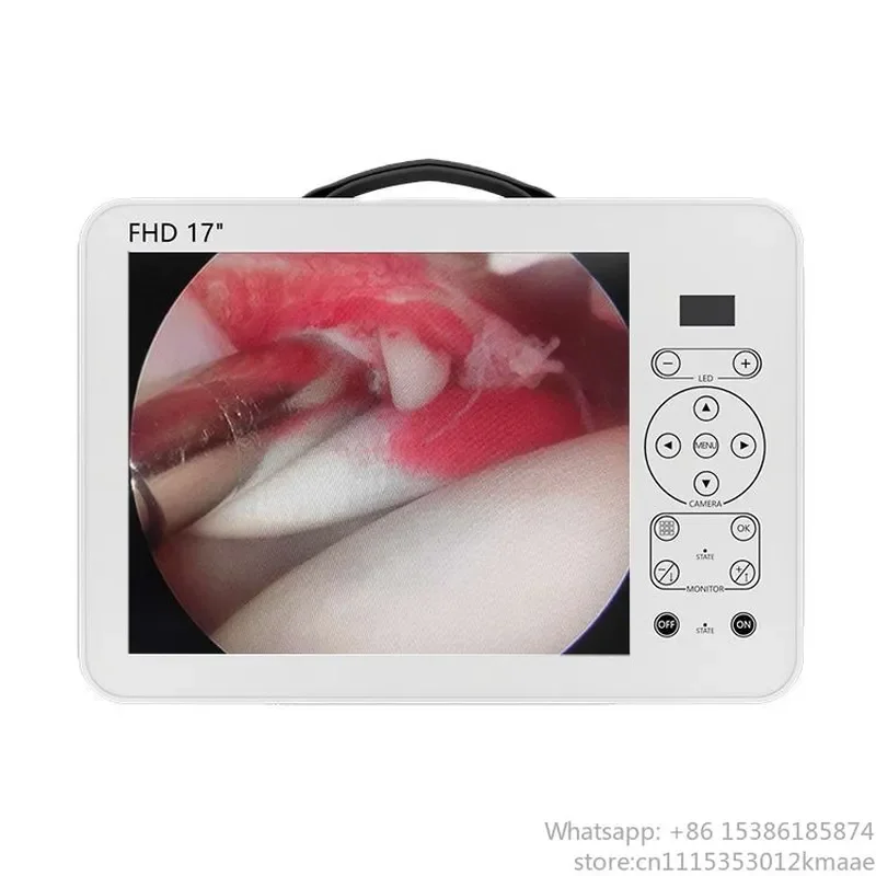 Vequyn Veterinary Rigid Endoscopy Camera System with 17