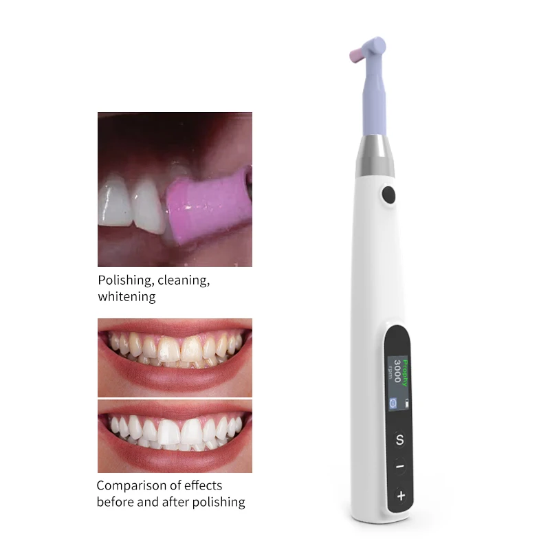 

Wireless Rechargeable Dental Polishing Motor Handpiece - 3000rpm Electric with Prophy Angle Attachments, Portable Oral Care Tool