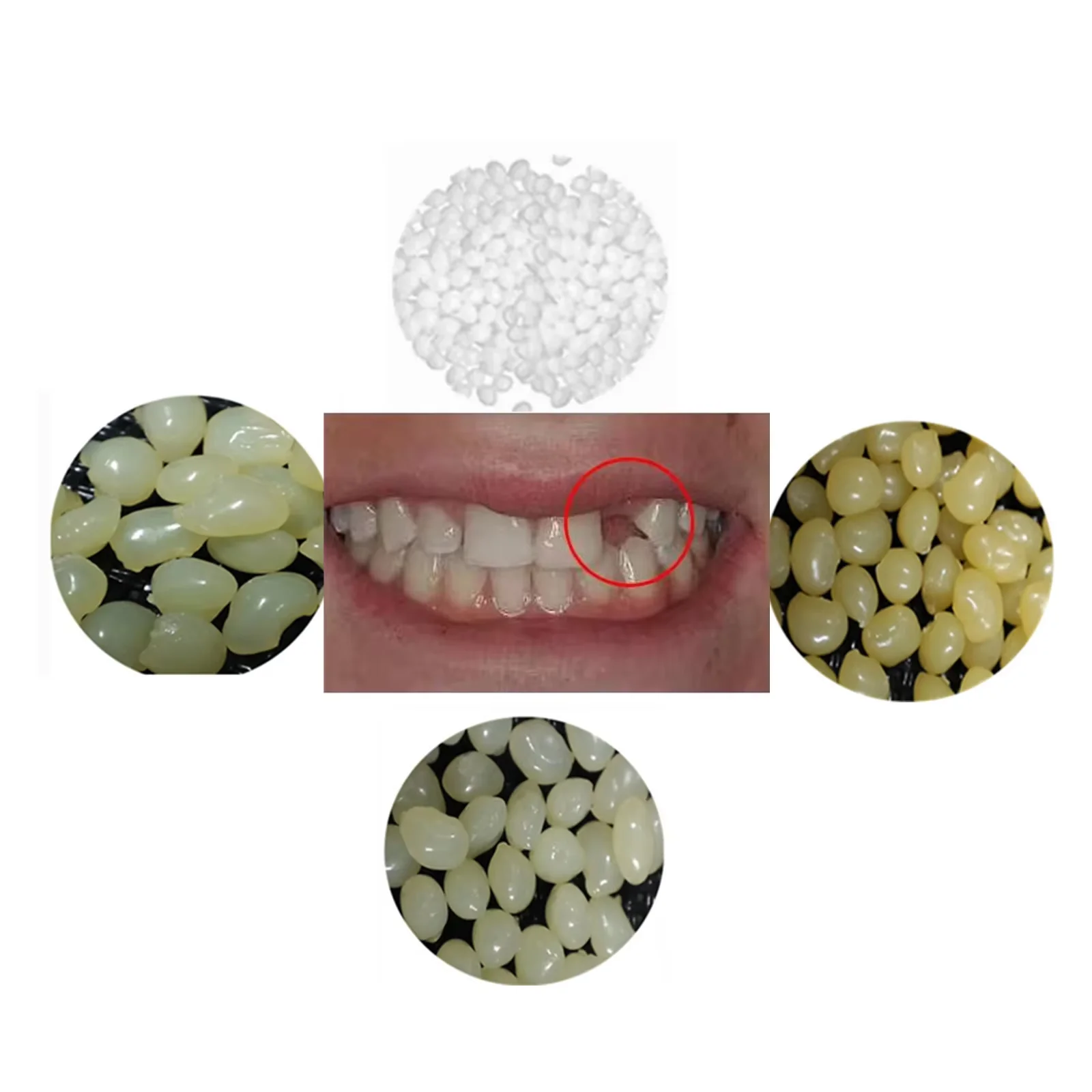 4Colors Dental Oral False Fake Teeth Tooth Filling Repair Smile Snap on Veneers Dentures Case Paste Adhesive Beads Cosmetic Sets