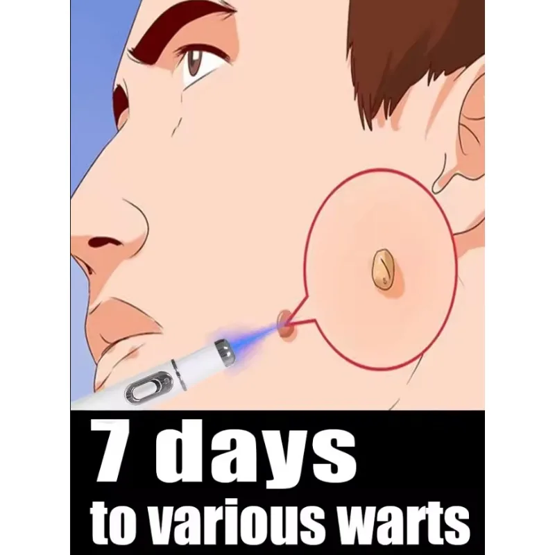 Verruche améliorée de 1ère génération réparer la racine des verrues uickly 9