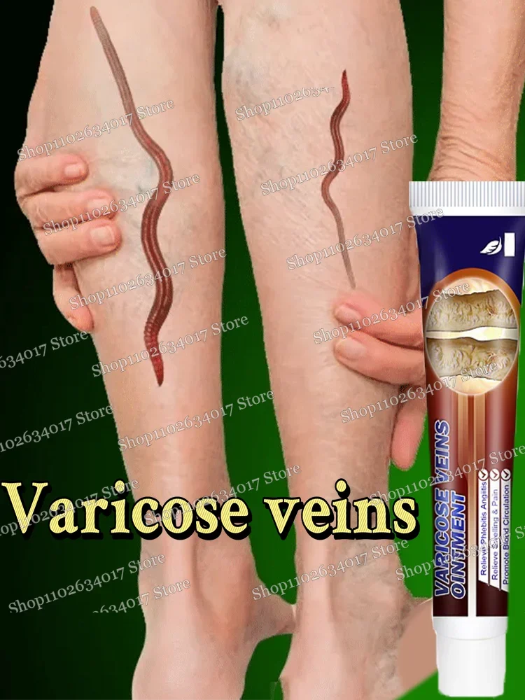 

Safe and effective varicose vein removal Effective treatment of vasculitis Fast treatment of leg varicose vein removal Fast