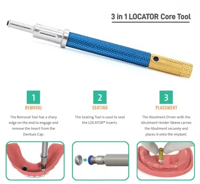 

1pcs Dental Screw Locator Core Tool Universal Insertion Extraction Tool Remove Locator 3 in 1 Core Tool Metal Handle