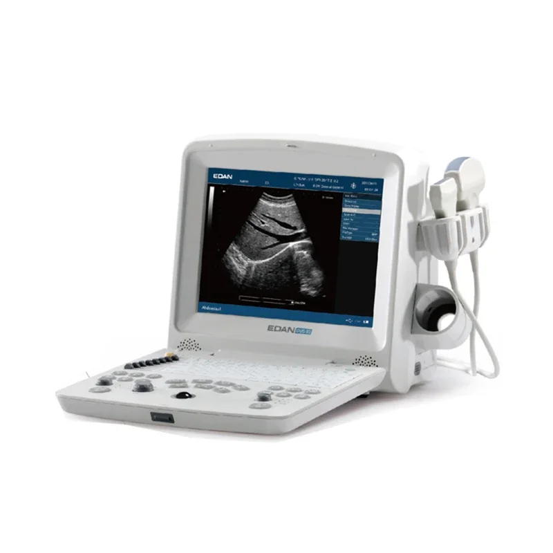 portable Edan ultrasound machine black and white ultrasound machines