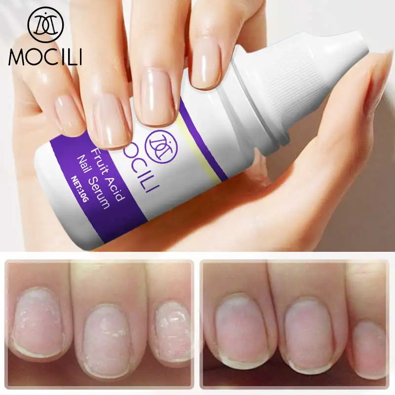 3pcs Fruit Acid Nail Serum Repairs Nourish Nail Improve Rough Nail Surface Make Nails Look More Beautiful Nail Care