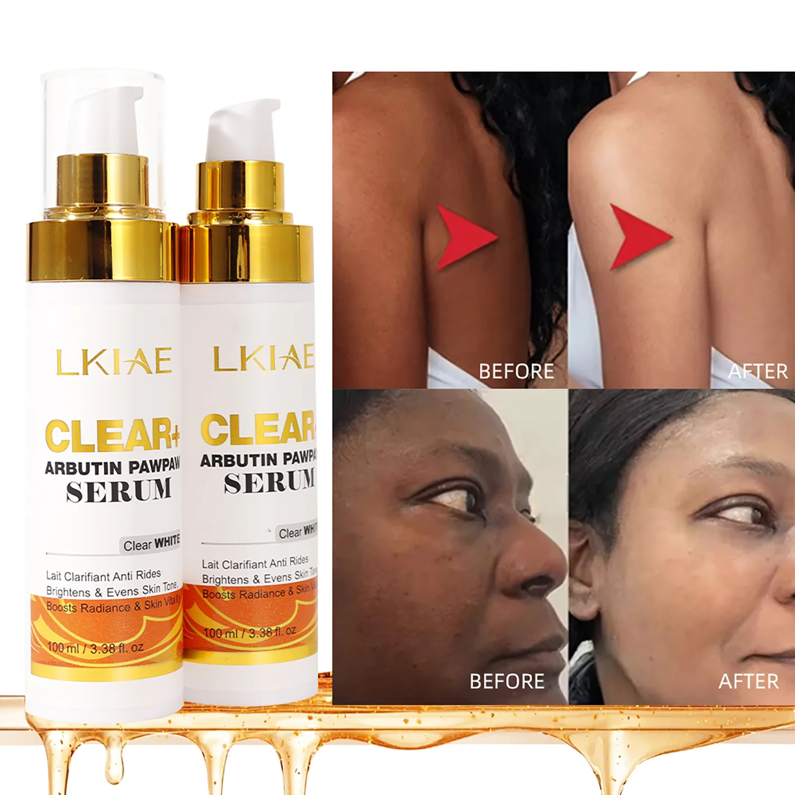 

LKIAE Arbutin Lightening Serum, Hydrating, Remove Freckle, Black Spots, Melanin, Hyperpigmentation, For All Skin Types Essence