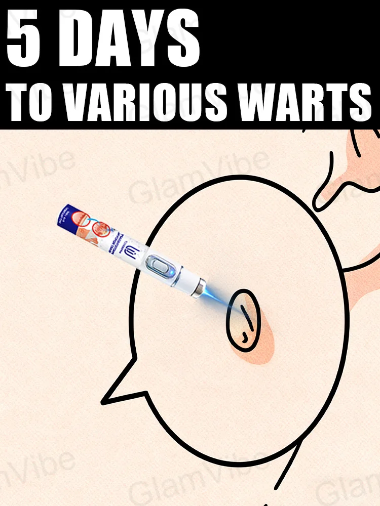 Niebieski długopis na brodawki, popularne narzędzia do leczenia brodawek.