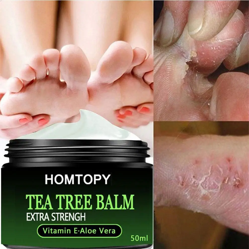Anti-Drying Crack Foot Cream Heel Cracked Repair Cream Removal Dead Skin Hand Feet Care Hand and Foot Skin Care