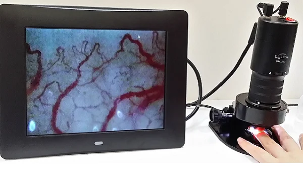 DMX980-1Microcirculation Microscope for lcd  microscope electron microscope