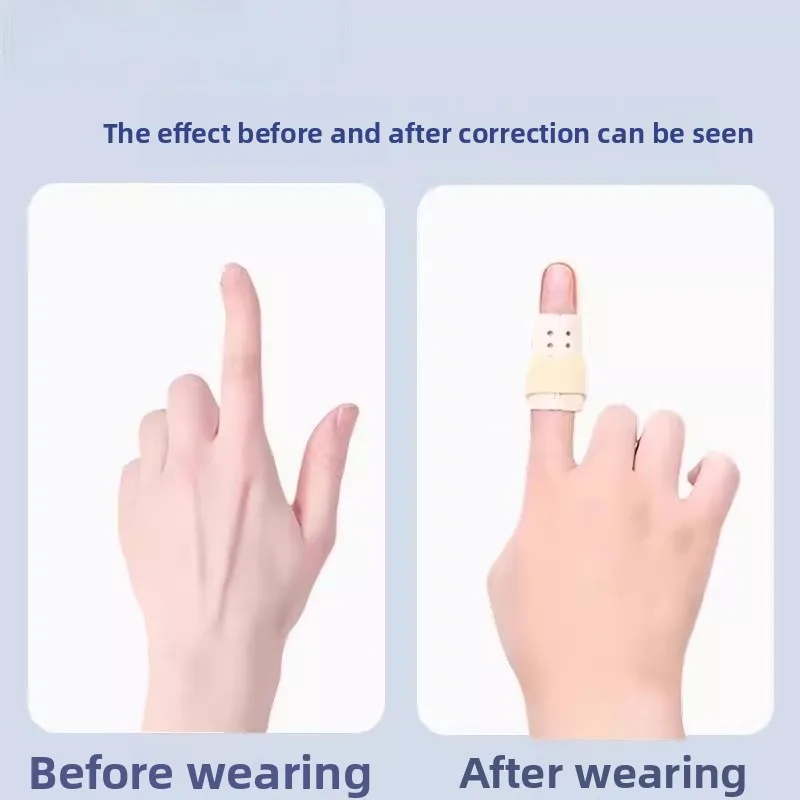

Curved Finger Correction Guard 20PCS Stabilizing Splint Sleeve Accelerate Recovery of Tendon Injury and Broken Finger Bones
