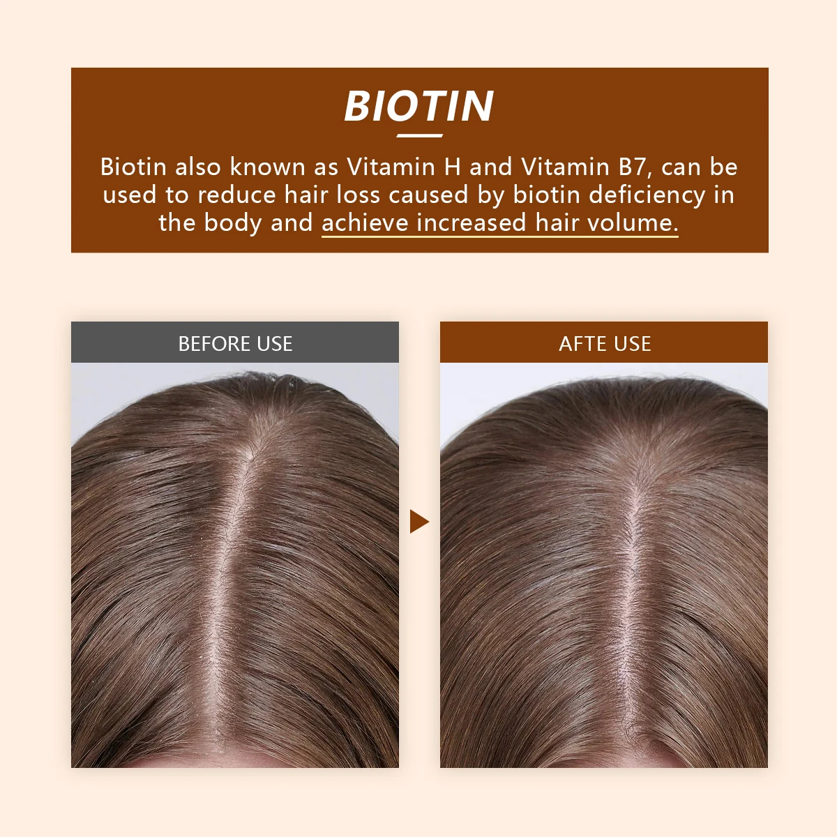 PURC Biotin Shampoo And Conditioner Set Anti Hair Loss Hair Thickening Treatment For Thinning Hair Scalp Care Men Women