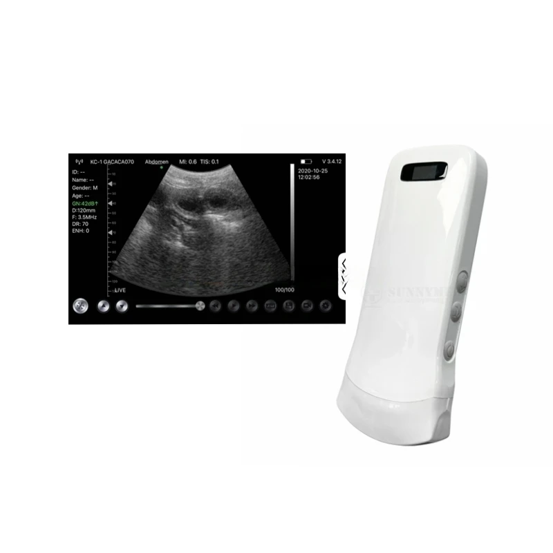 SY-A0C1 Portable Smartphone USB Doppler Micro Convex Wifi Ultrasound Scanner