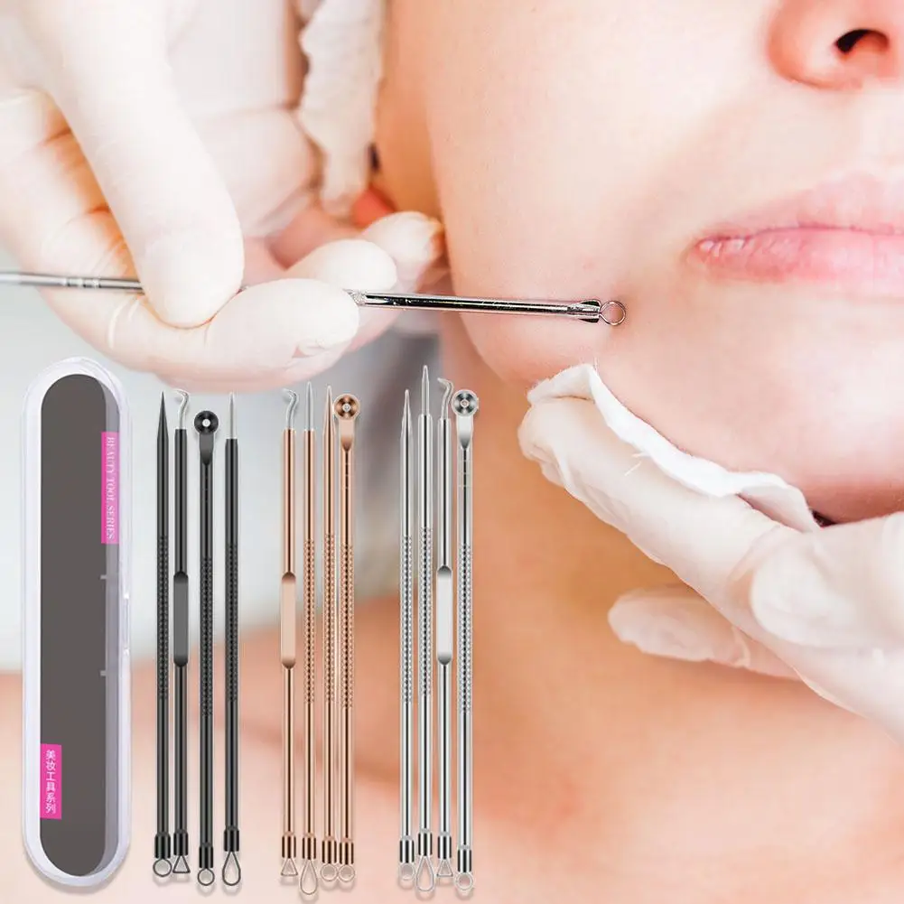 1pc Carbon Steel Antibacterial Blackhead Remover Tool  Remove Blackheads Whiteheads Pimples Spots Acne Face Clean Beauty Salon