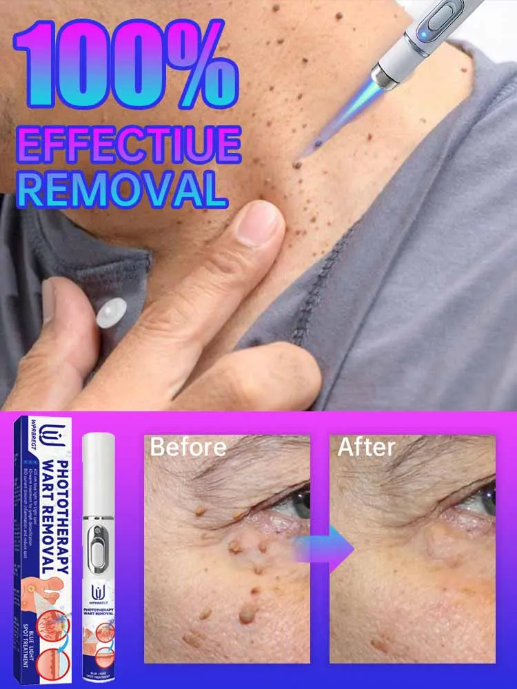 Fʟᴀᴡʟᴇss sᴋɪɴ