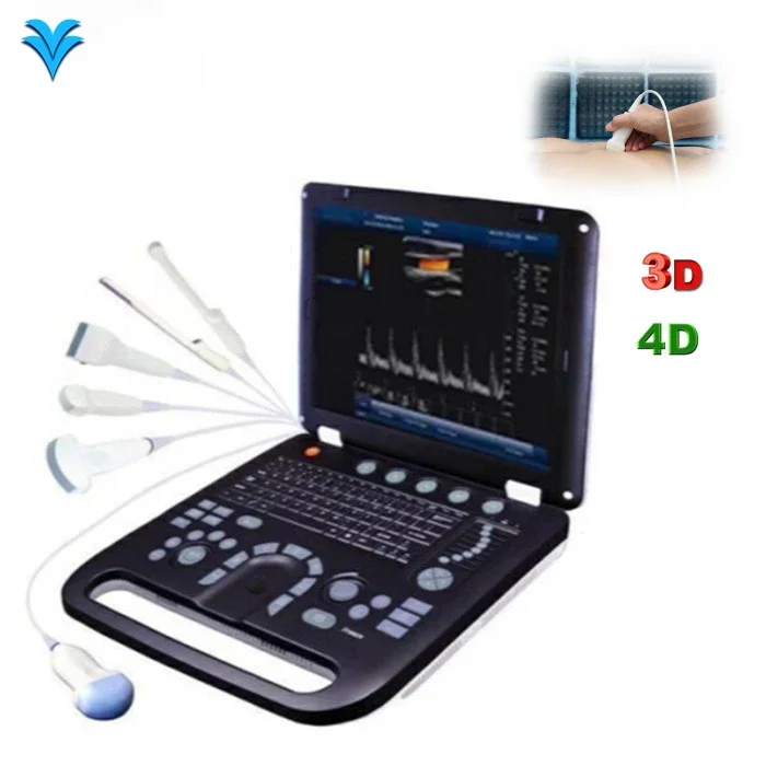 Best price 128 elements Cardiac CW medical portable echocardiography color doppler ultrasound machine