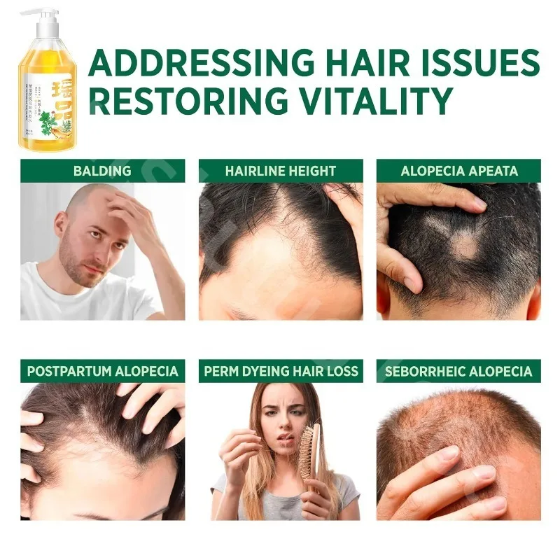 Yao Pin Anti-stripping Shampoo Herbal Shampoo Improving White Hair Loss, Anti-dandruff, Anti-itching and Compliant Oil Control