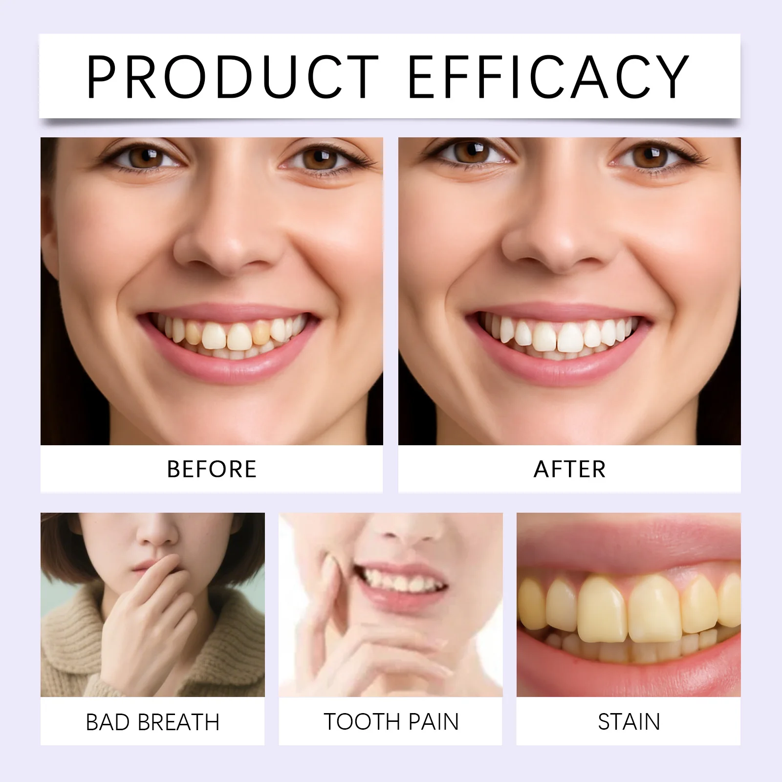 ORALHOE 3 قطعة/صندوق قلم تبييض الأسنان إزالة البقع الفعالة تصميم محمول سهل الاستخدام تركيبة خفيفة تأثير سريع طويل الأمد