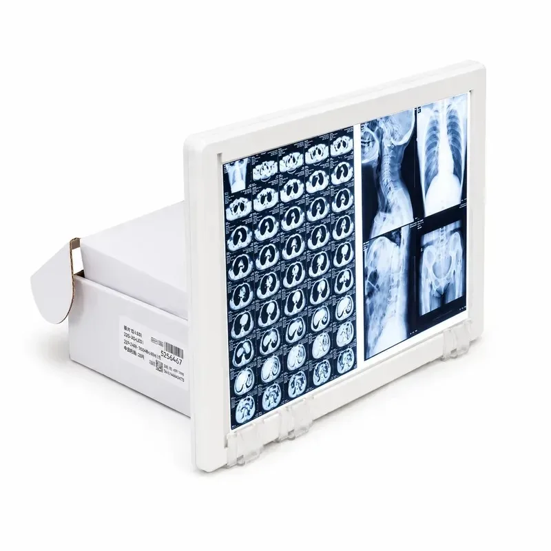 Hot Sale High-performance Xray Viewer Double Panel Led Negatoscope Medical LED X Ray Cihaz Pan Imaging Film Viewer View Box