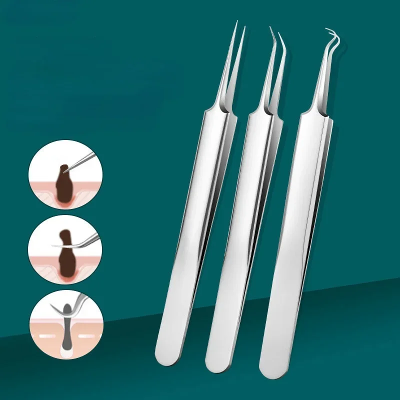 Set Stainless Steel Acne Removal Needles Pimple Blackhead Remover Tools Spoons Face Skin Care Tools Needles Facial Pore Cleaner