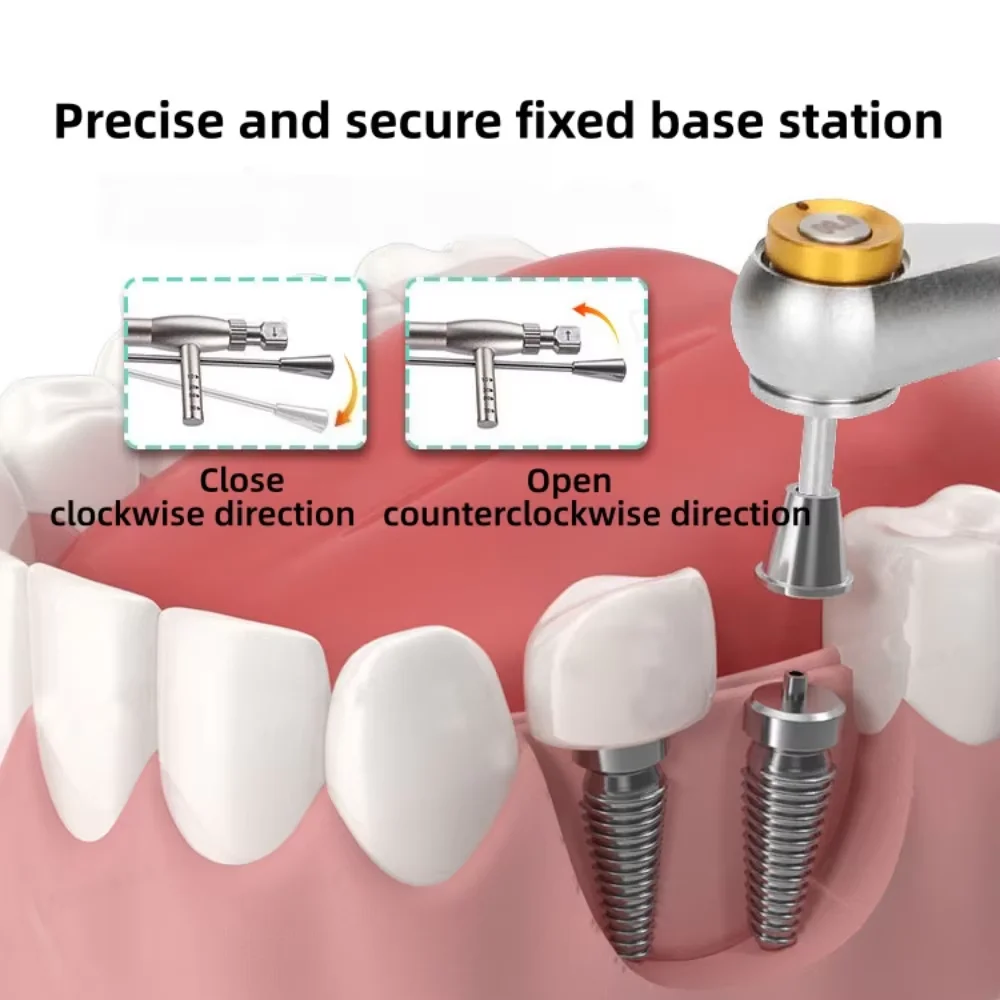 1 Set Dental Implant Tools Including Screwdriver Torque Wrench Ratchet Kit Abutment Fixing & Prosthetic Restoration