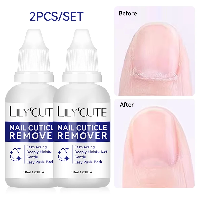 LILYCUTE 2/3/5/10個入り 30ml ネイルキューティクルリムーバー クイック軟化ジェル ネイルスキン用 優しいリムーバー マニキュアクリーナー ツールキット