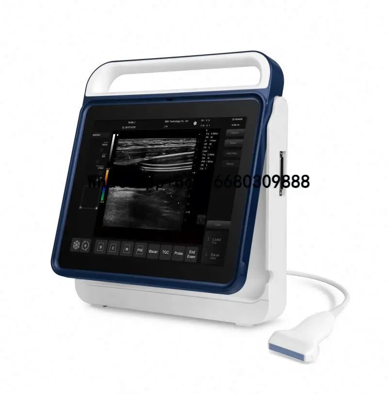 

Portable Vet Ultrasound Machine Veterinary Ultrasound Ovum Pick-Up Egg Collection Ultrasound Scanner