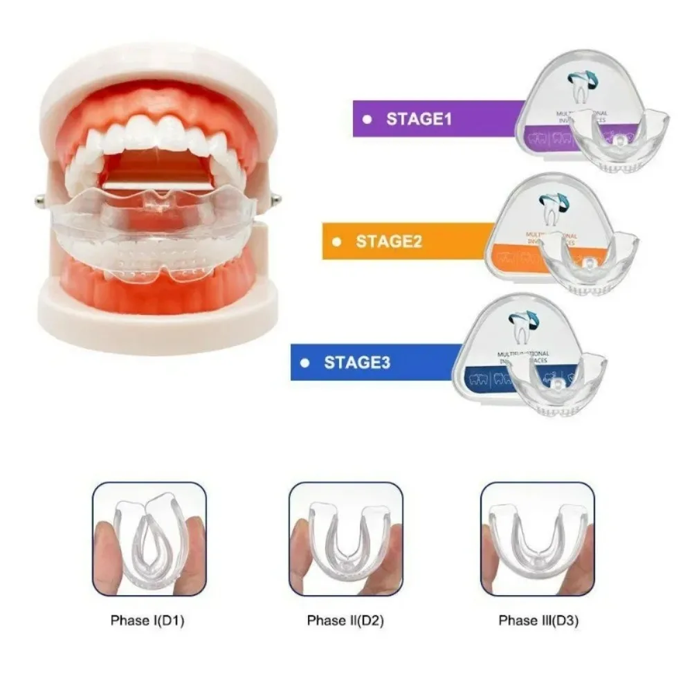 Dental Braces Teeth Trainer Alignment Mouthpiece Tooth Orthodontic Brace Straightener for Adults 3 Stages Dental Accessories