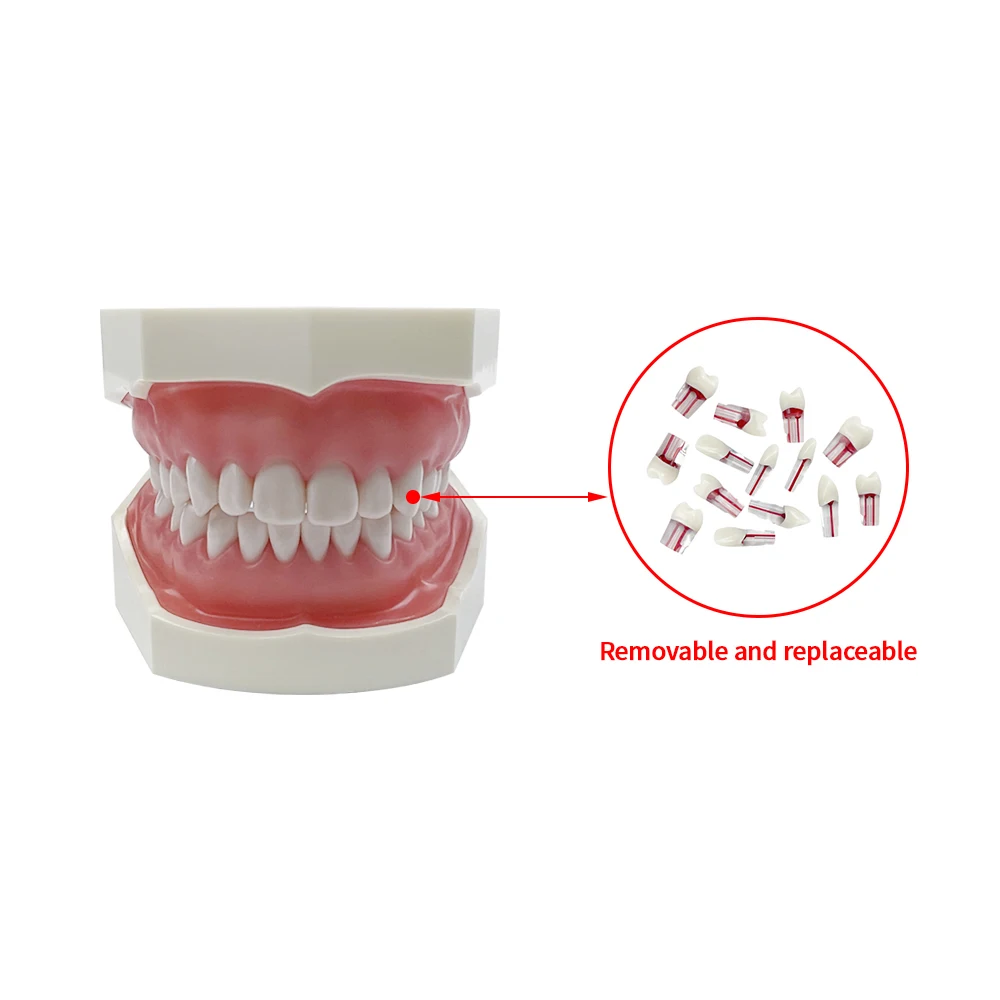 Modelos de conducto radicular de dientes dentales, bloque RCT de endodoncia, modelo de práctica de cavidad de pulpa, modelo de estudio de cavidad de pulpa, productos de odontología