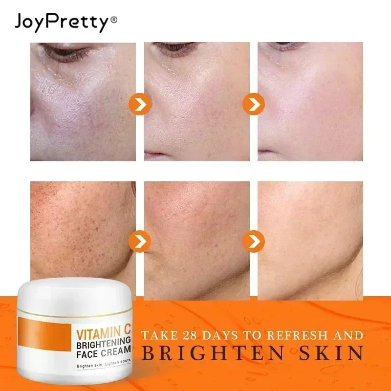 Anti-Freckle Skin Whitening Cream Removes Melanin Dullness Reduces Age Spots Freckles Facial Moisturizing Brightening Face Care