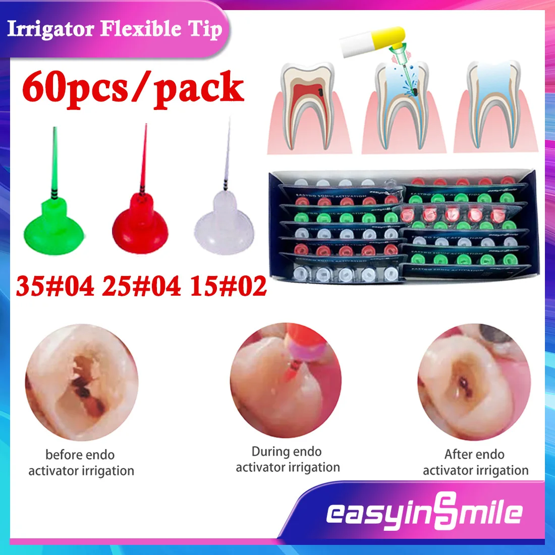 EASYINSMILE 60Pcs Sonic Irrigator Flexible Tips Dental Endodontic Root Canal Activator Clean 3Types #15#25#35