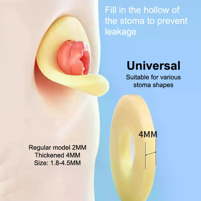 Barrier Stoma Ostomy Strips Tape Skin Supplies Strip Rings Nursing Adhesive Pressure Fixing Colostomy Leak Proof Ileostomy Pouch