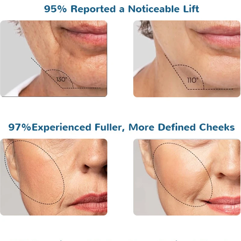 Red Blue Light Vibration Facial Massager Beauty Device Face Lifting Device Skin Tighten Wrinkle Removal Hot Cool Face Skin Care