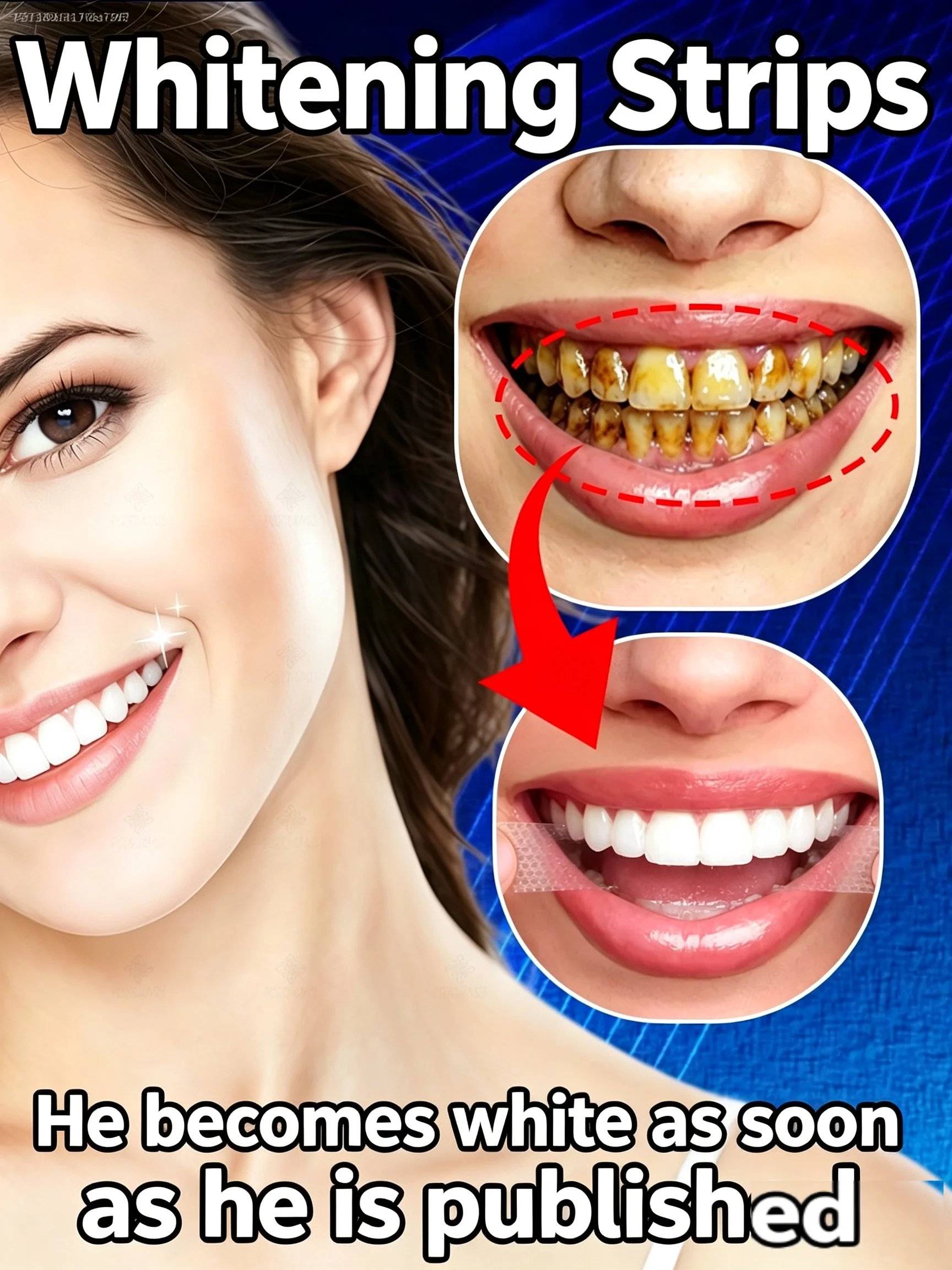 At Home Teeth Whitening Strips Tartar Removal