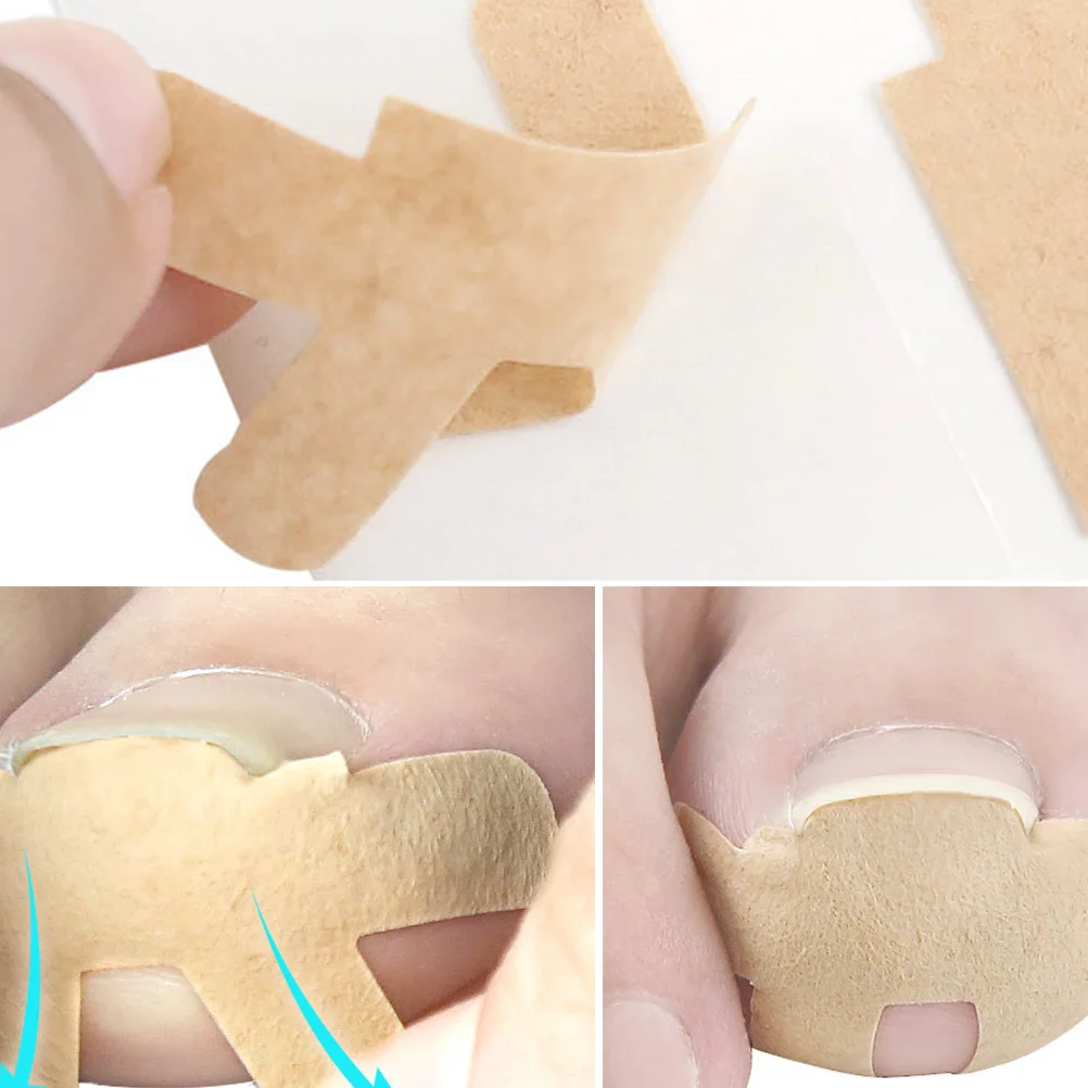 

3 Sheets Groove Correction Patch Toe Nail Correction Sticker Ingrown Nail Corrector Stretchy Lightweight Anti-Wear Paronychia