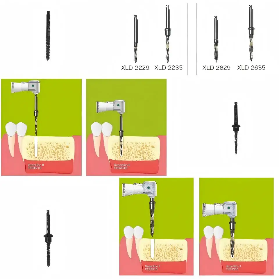 Dental Implant Lindemann Drill Kit First and Second Guide Drills XLD2229 XLD2235 XLD2629 XLD2635 Surgical Tool