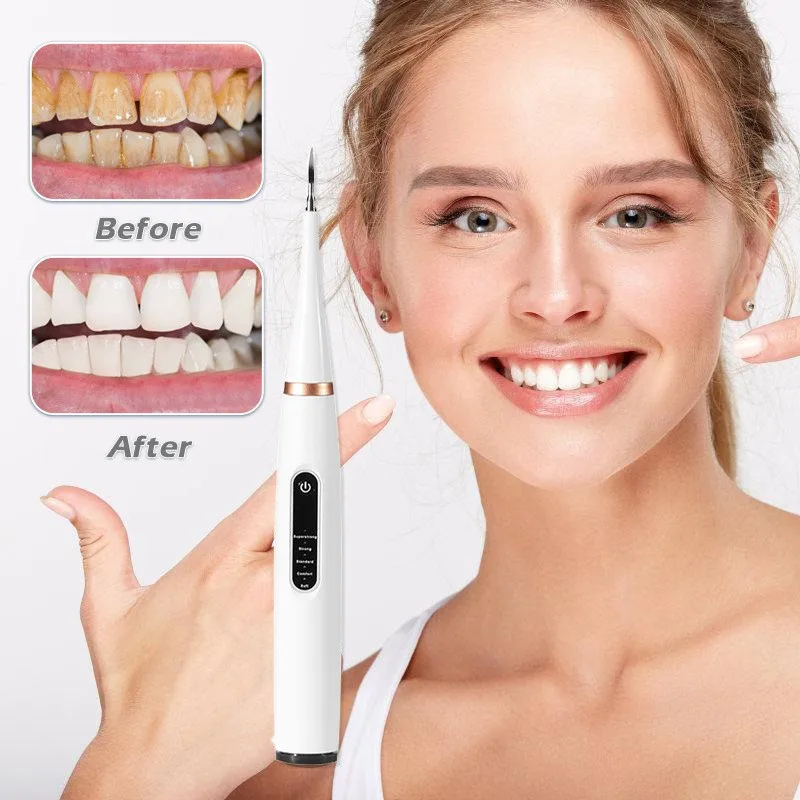 Limpiador Dental ultrasónico eléctrico, raspador Dental, removedor de sarro, manchas de cálculo Dental, irrigador Oral, herramienta de