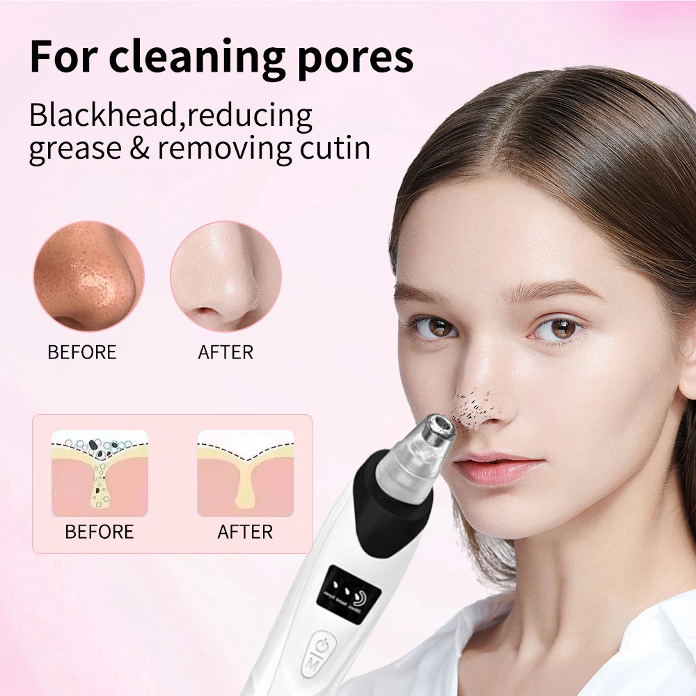 منظف المسام الكهربائي الجديد لعام 2025 ومزيل الرؤوس السوداء - جهاز مكنسة التنظيف العميق للعناية بالوجه وأدوات العناية ببشرة الوجه