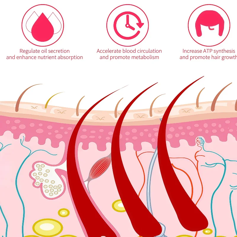 

LLLT Шапочка для роста волос Беспроводная терапия красным светом 80 шт. Медицинские диоды для предотвращения выпадения волос